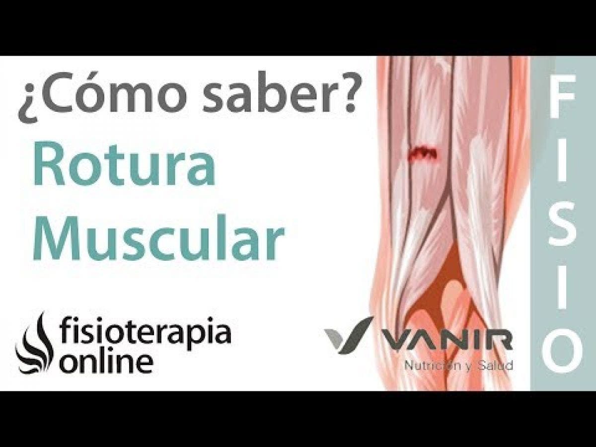 distension muscular ingle sintomas